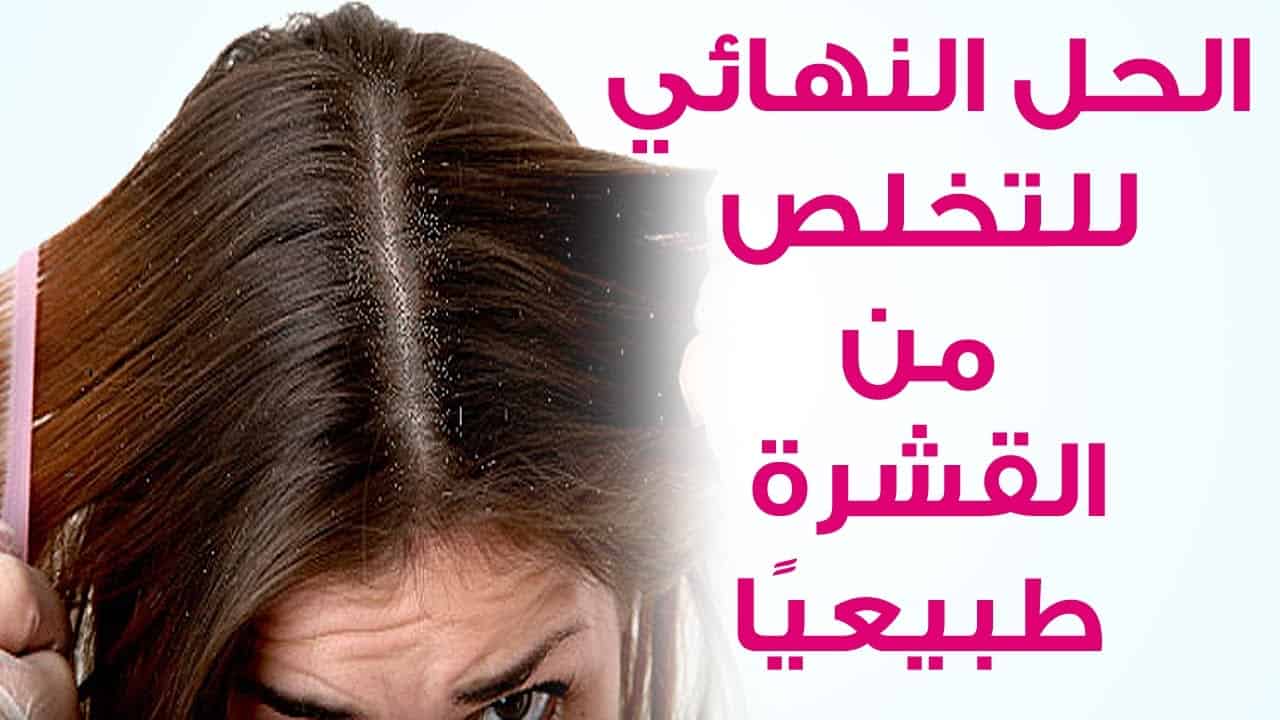 تخلص من قشرة الشعر نهائيا , اتخلص من القشره اللي في شعرك بسرعه