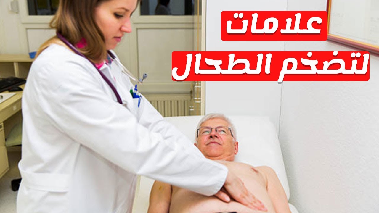 مشاكل في الطحال هقلك الحل , تضخم الطحال