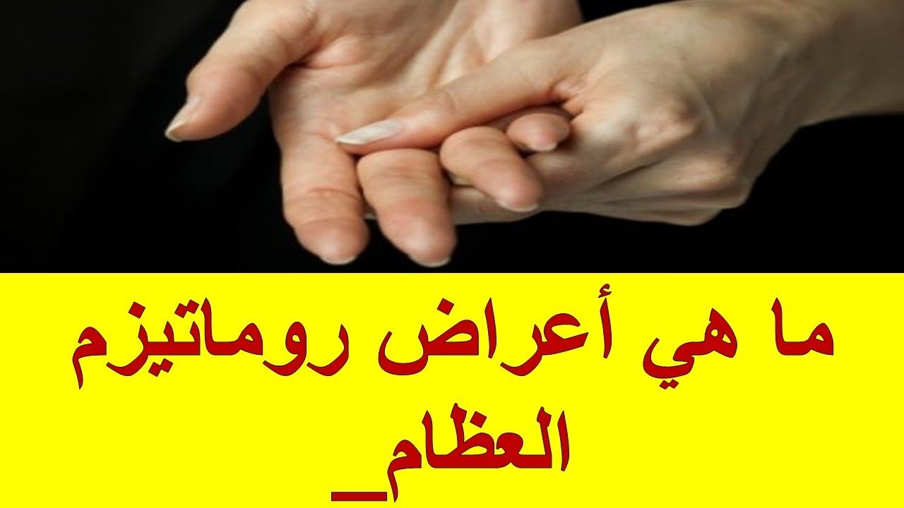 اعراض الروماتيزم - كيف تعرف انك مريض روماتيزم