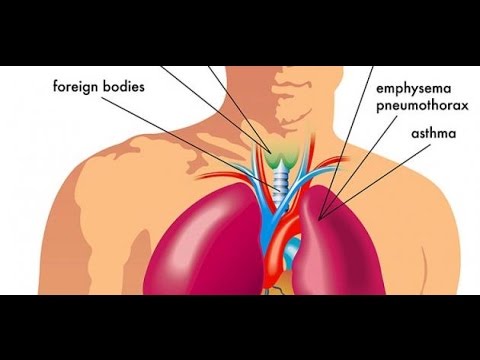 اسباب ضيق التنفس , اعراض واسباب ضيق التنفس