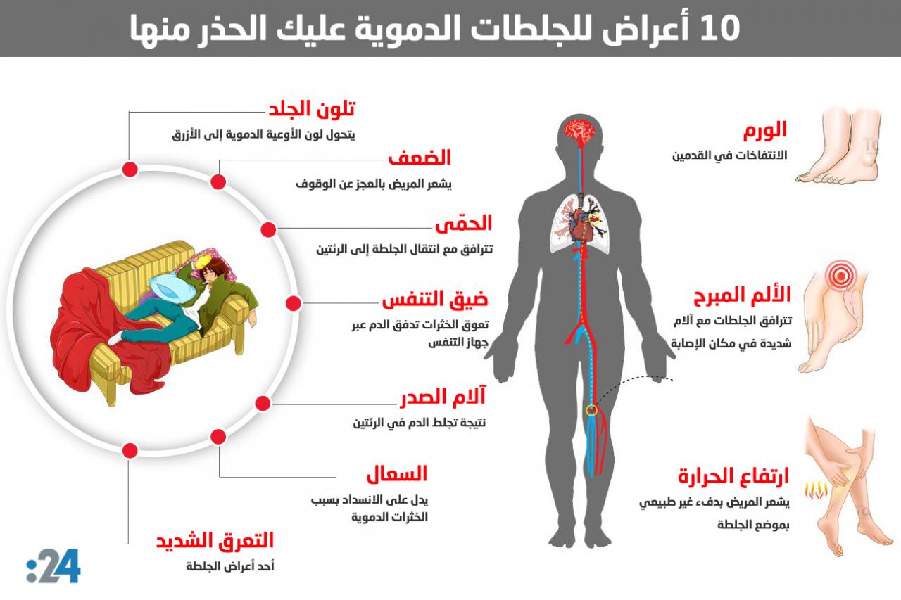 اعراض الجلطة