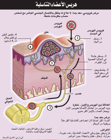 مرض الهربس , تعرف اكثر علي مرض الهربس اعراضه و طريقة انتقاله