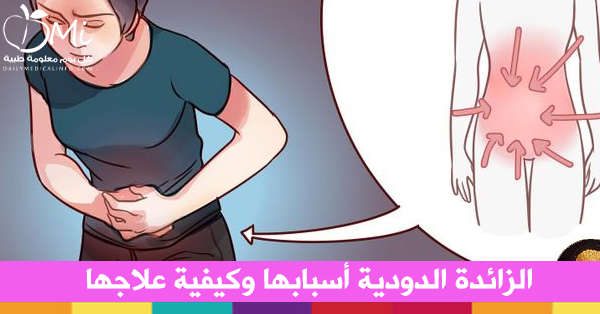 اعراض الزائدة الدودية , الاسباب والاعراض الشائعة