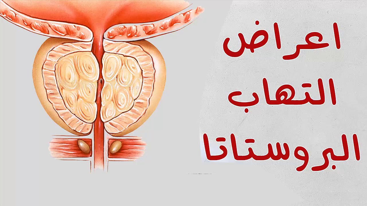 اعراض البروستاتا , ماهي اعراض التهاب البروستاتا