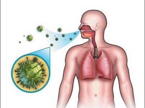 مرض الطاعون , اعراض امراض الطاعون وانواعه