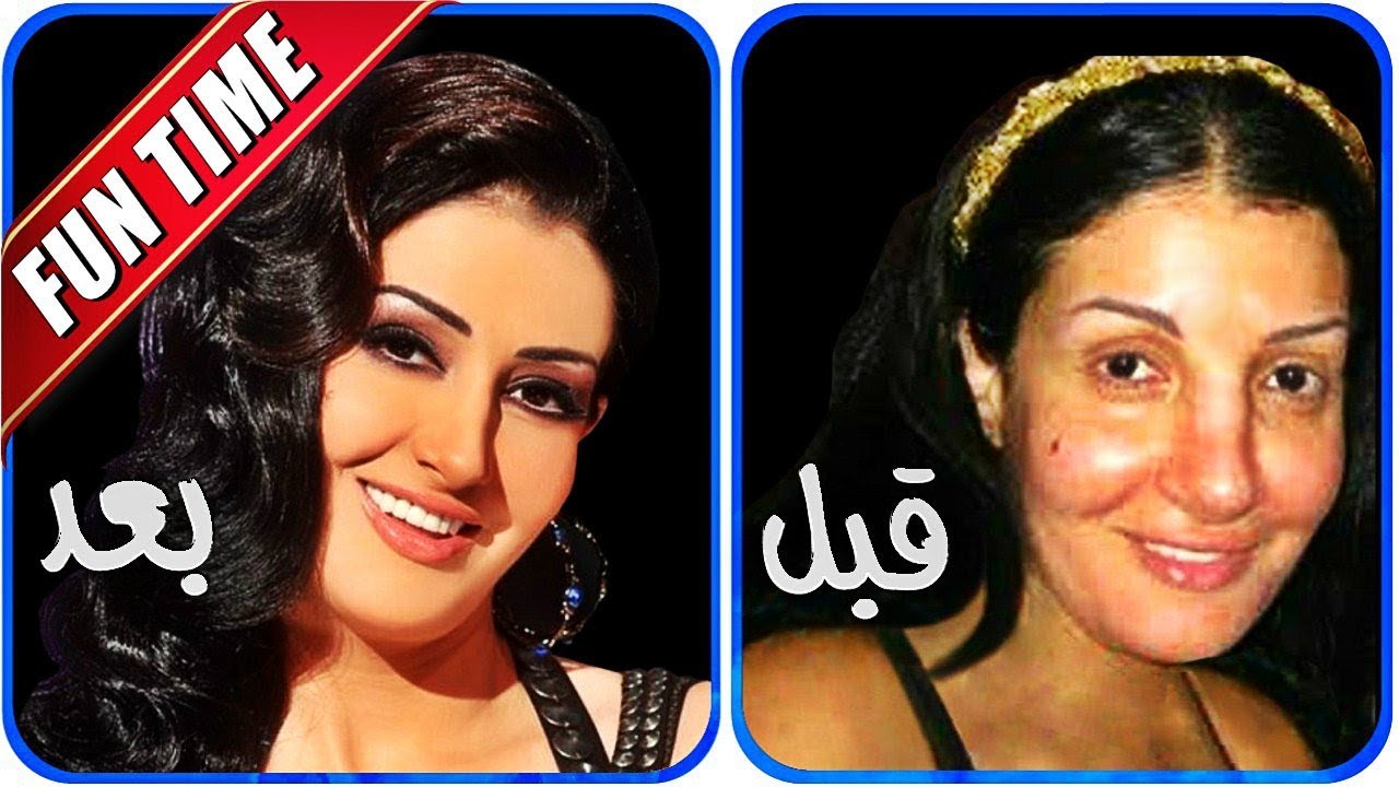 صور الفانين قبل عمليات التجميل- مجموعه صور للفنانين 11931 1