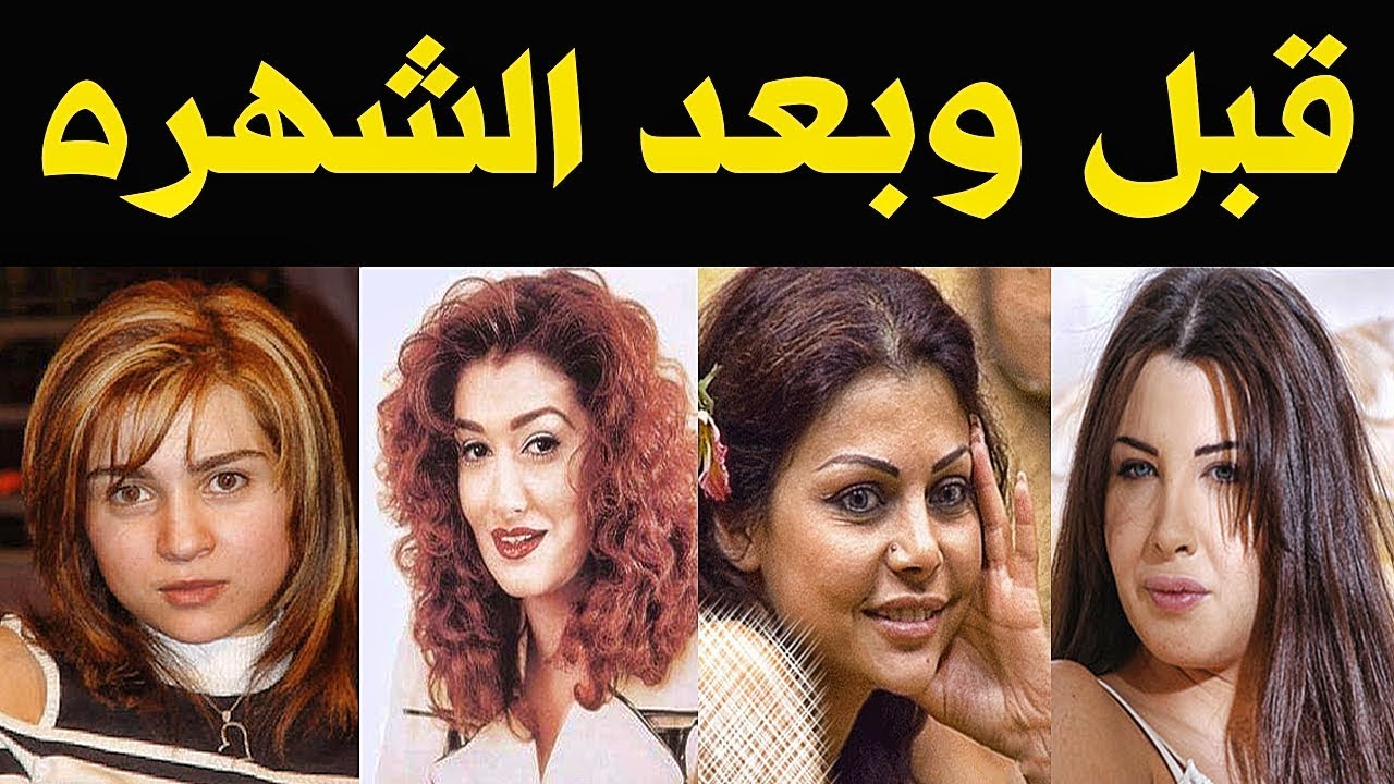 صور الفانين قبل عمليات التجميل- مجموعه صور للفنانين 11931 3