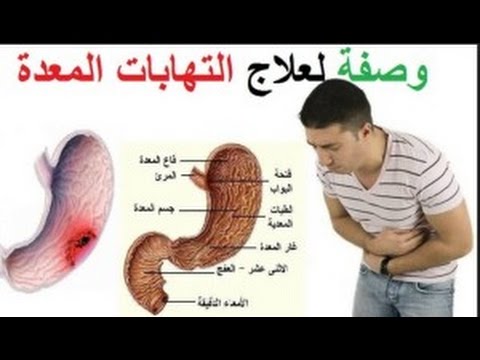 اعراض قرحة المعدة - ما هي اسباب واعراض قرحة المعدة 4671 2