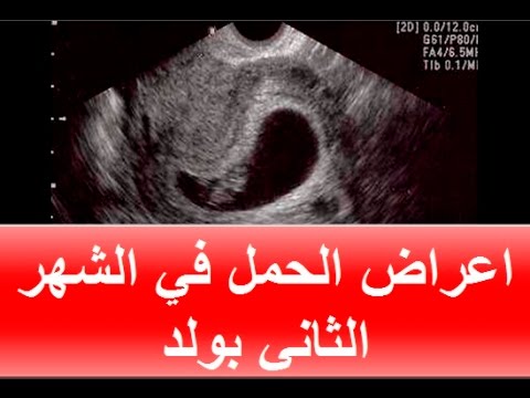 اعراض الحمل بولد , علامات مشهورة للحمل بولد